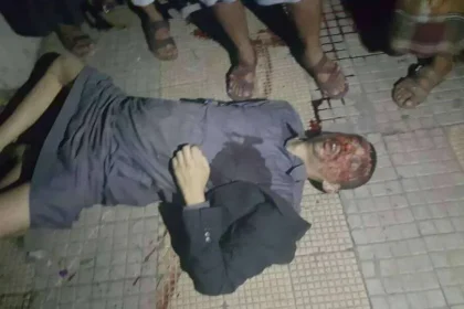 صور من مقتل خالد الرضي في إشتباكات جولة المصباحي وبيان المؤتمر حول مقتله