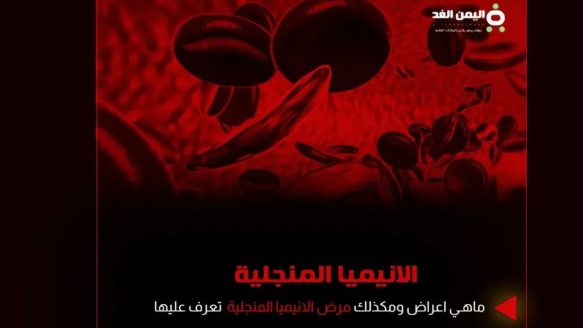 الانيميا المنجلية فقر الدم المنجلي ماهو اسباب اعراض علاج مضاعفات anemia