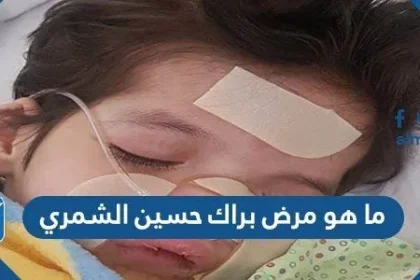 ما هو مرض براك حسين الشمري