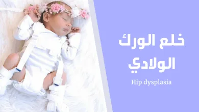 خلع الورك الولادي؛ الأسباب وطرق العلاج