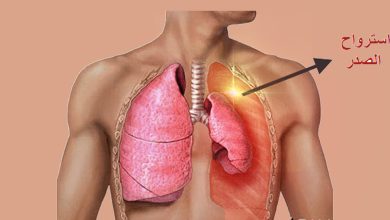 ماهو إسترواح الصدر الأعراض الأسباب وطرق العلاج Pneumothorax