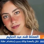 إصابتها بشلل في المعدة