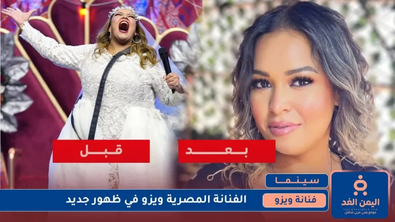 صور الفنانة ويزو قبل وبعد وما هي حقيقة الصور هل حميه ام AI صور الفنانة ويزو