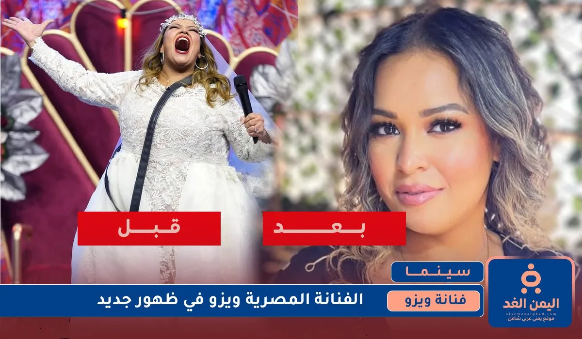 صور الفنانة ويزو قبل وبعد وما هي حقيقة الصور هل حميه ام AI صور الفنانة ويزو