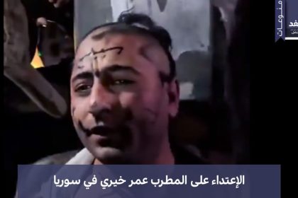 ضرب المطرب عمر خيري