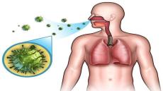 ماهو مرض وباء الدفتيريا ” الخناق ” Diphtheria